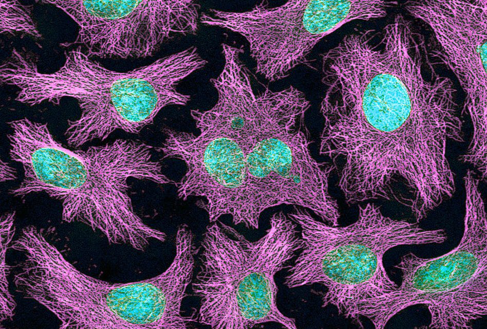 Les cèl·lules d’Henrietta Lacks (HeLa)<span class="wtr-time-wrap block after-title"><span class="wtr-time-number">4</span> min de lectura</span>