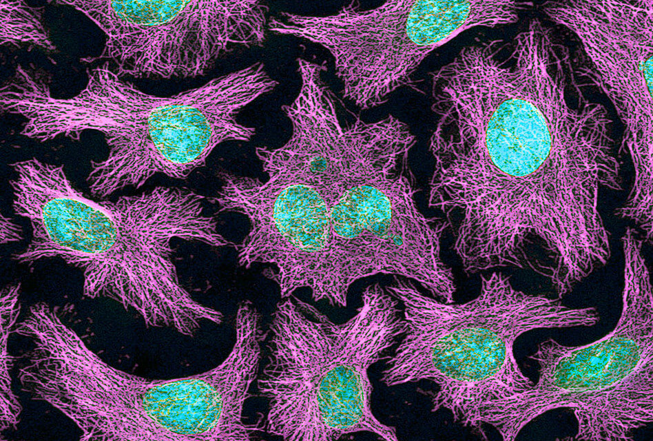 Qu'est-ce que les cellules hela