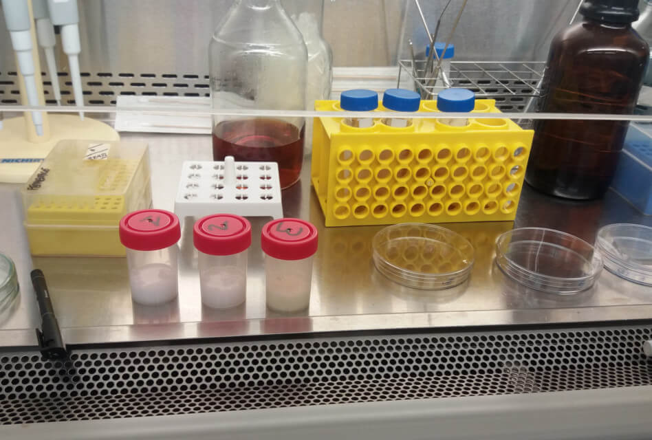 Bojos per la Bioquímica<span class="wtr-time-wrap block after-title"><span class="wtr-time-number">4</span> min de lectura</span>