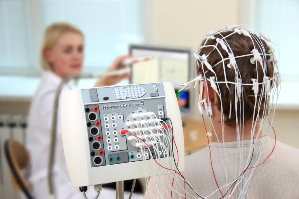 Electroencefalografia