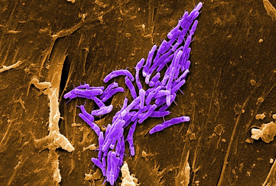 Com es comuniquen els bacteris? La percepció de quòrum<span class="wtr-time-wrap block after-title"><span class="wtr-time-number">6</span> min de lectura</span>